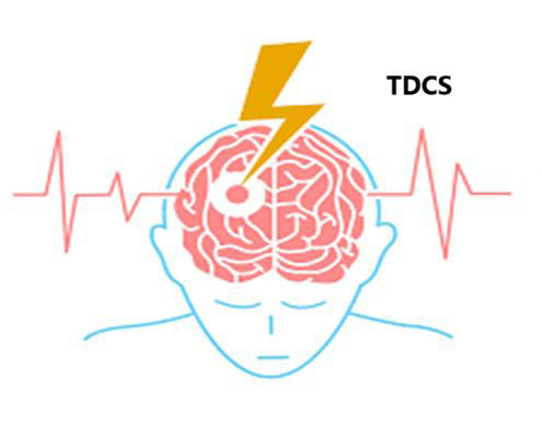 تی دی سی اس (TDCS)